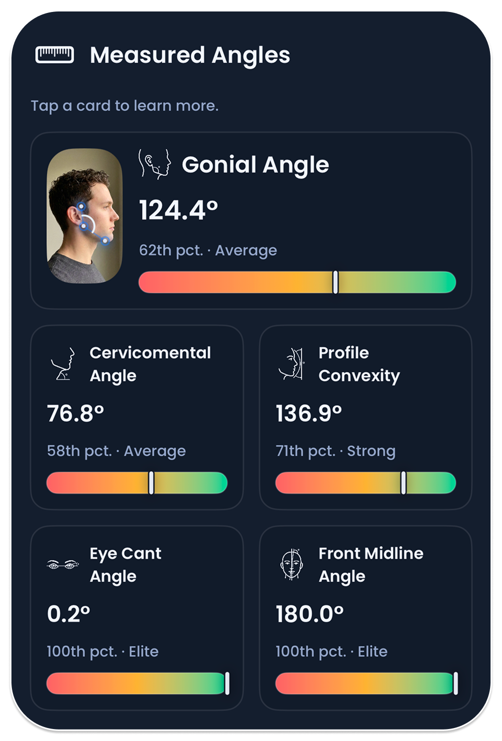 JawSculpt angle breakdown